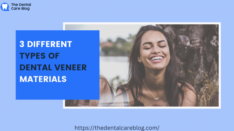 different types of veneers
