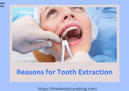 Reasons for Tooth Extraction