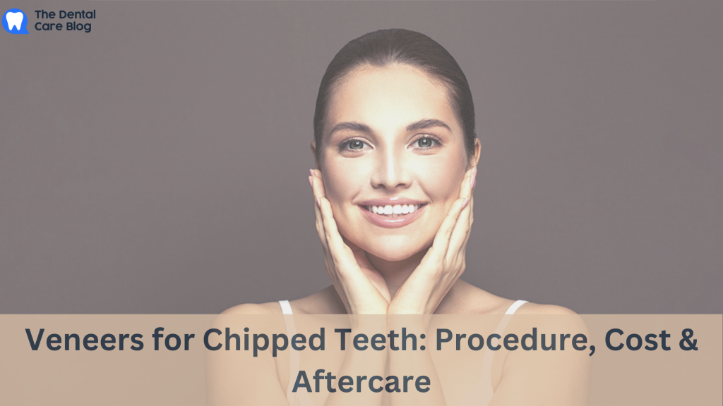 Veneers for Chipped Teeth: Procedure, Cost & Aftercare