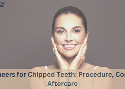 Veneers for Chipped Teeth: Procedure, Cost & Aftercare