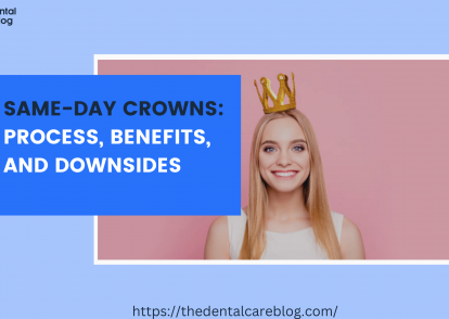 Same-Day Crowns: Process, Benefits, and Downsides